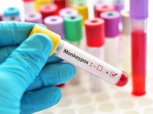 Monkeypox-PCR-test