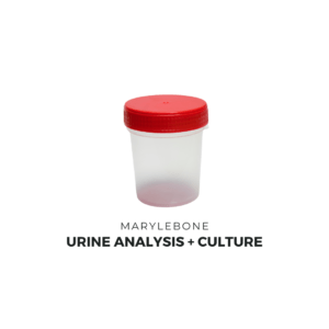 Urine Analysis and Culture